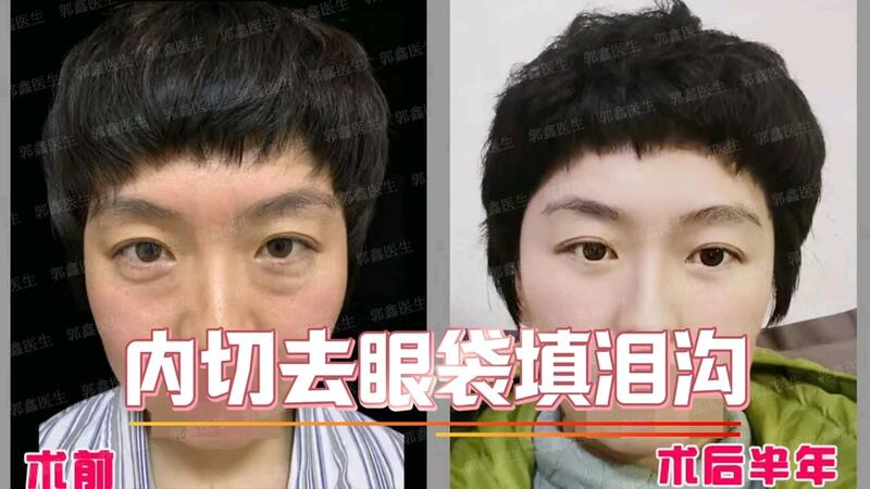 視頻封面