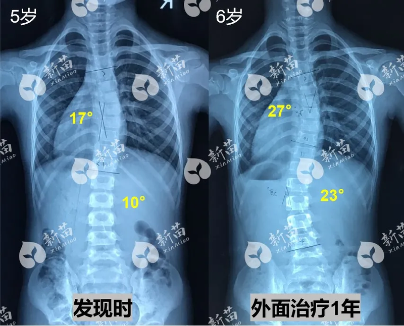 圖文圖片