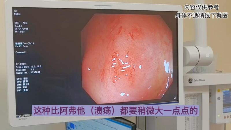 視頻封面