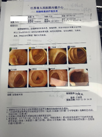 肠镜息肉报告图片