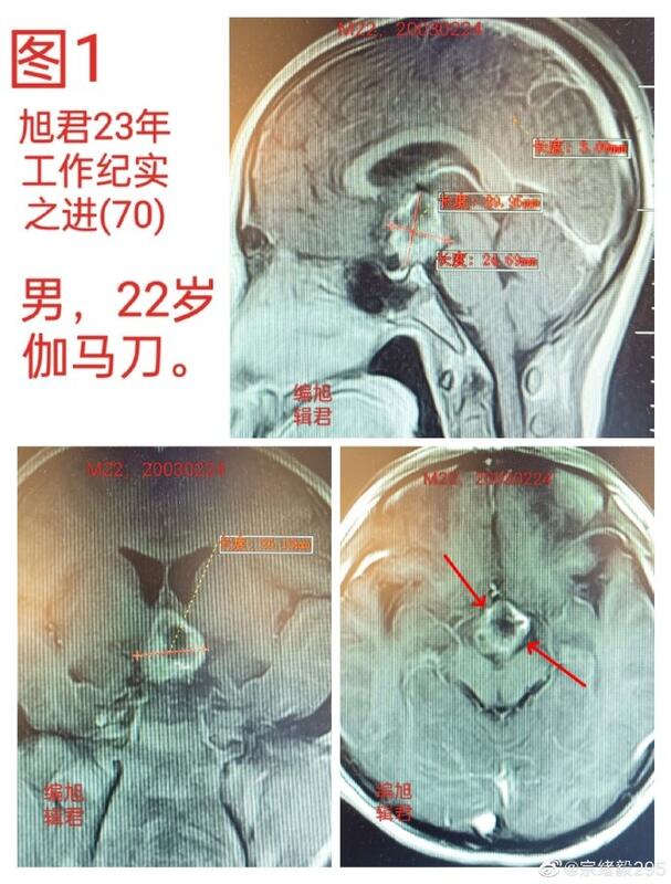 图文图片