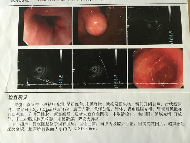 胃肠道间质瘤的标准诊断治疗流程
