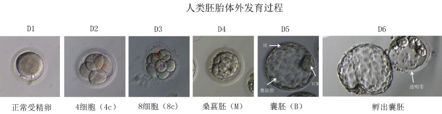 试管胚的评分 胚移植 冷冻及丢弃标准 试管婴儿 试管婴儿疾病介绍