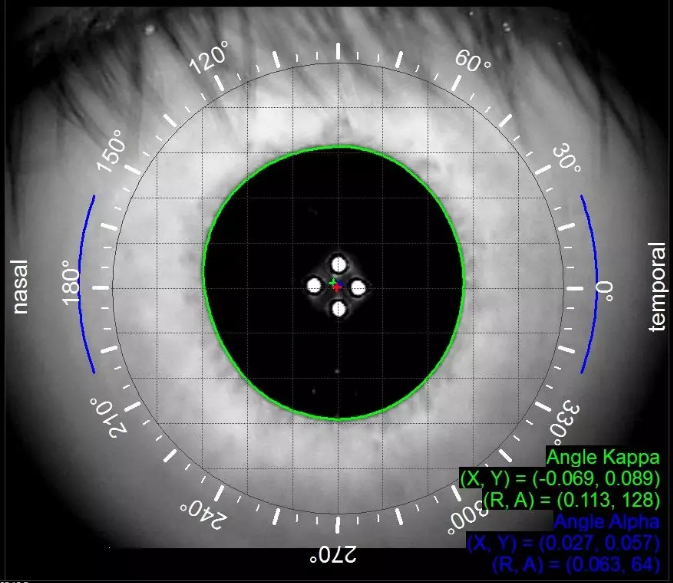 itrace视功能分析仪(tracey technologies,usa)是通过瞳孔中心为原点