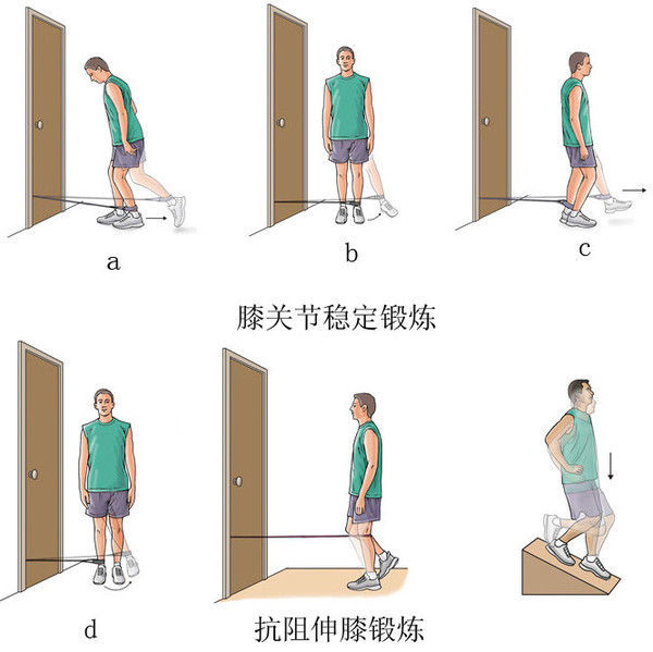 常见的膝前疼痛——髌股关节炎 - 好大夫在线