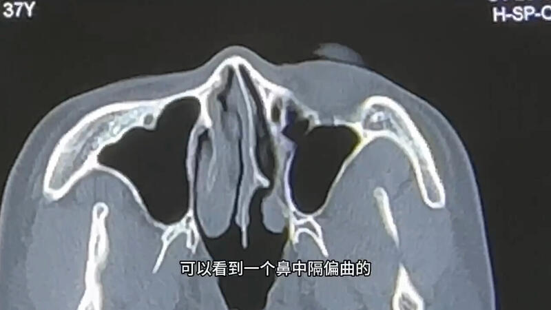 視頻封面