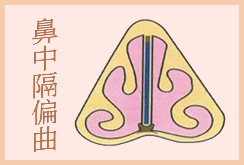 圖文圖片