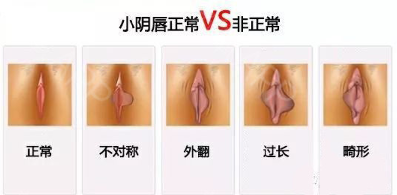 圖文圖片