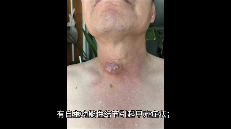 視頻封面