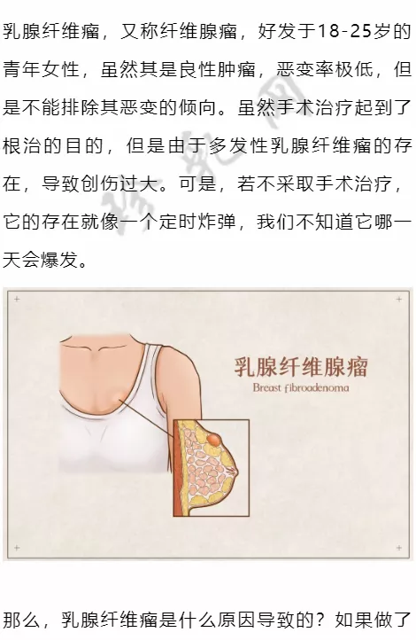 乳腺纖維腺瘤手術切除後,複發率,癌變率有多大?