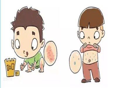 过敏性紫癜到底是何方妖怪