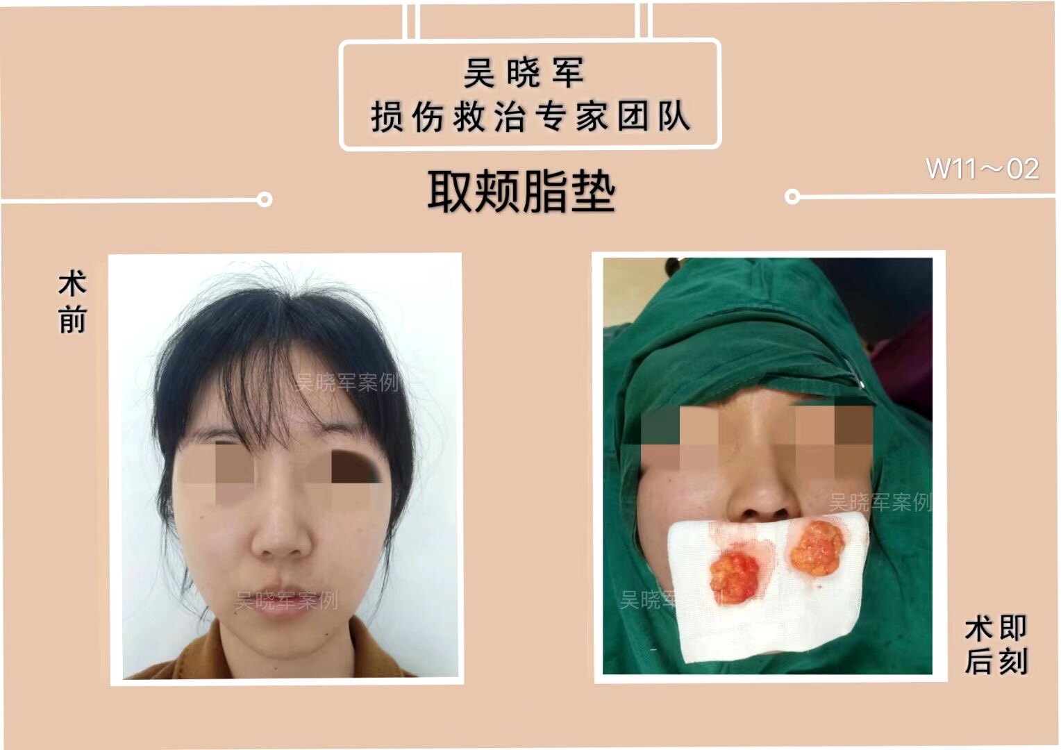 暂无