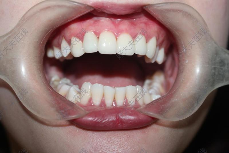 牙颌面畸形_牙颌畸形 - 好大夫在线