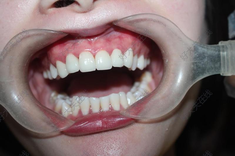 牙颌面畸形_牙颌畸形 - 好大夫在线