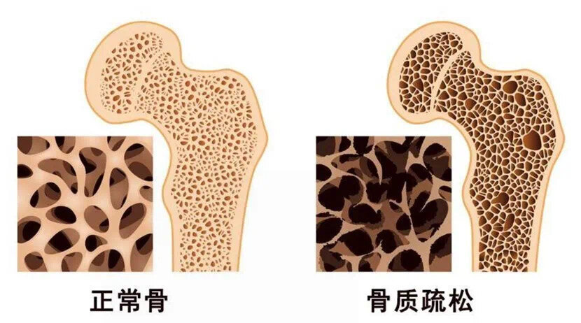 圖文圖片