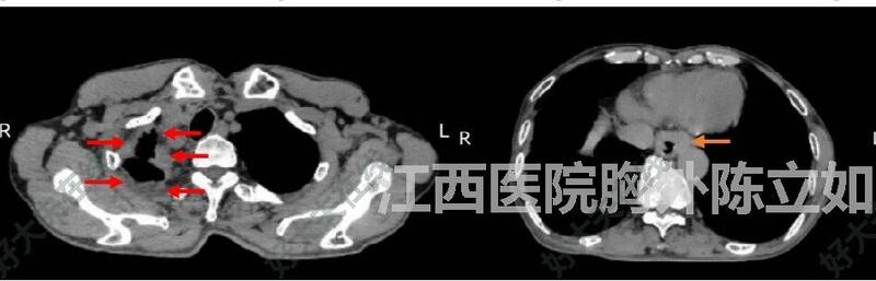 圖文圖片