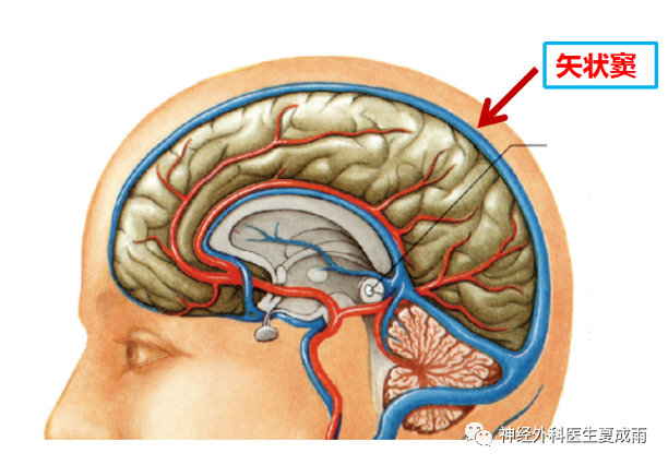 上矢状窦沟图片图片