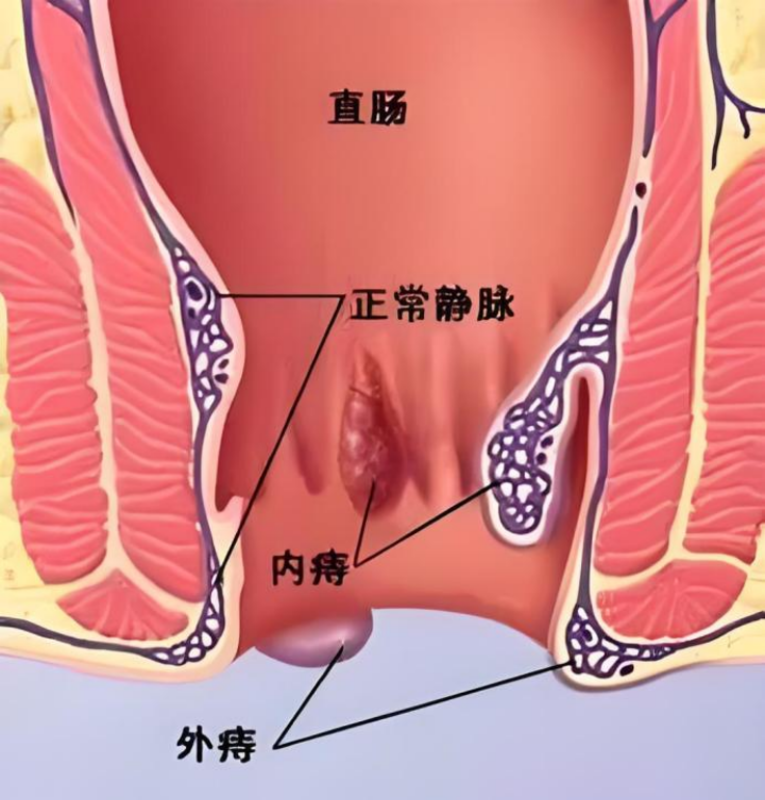 圖文圖片