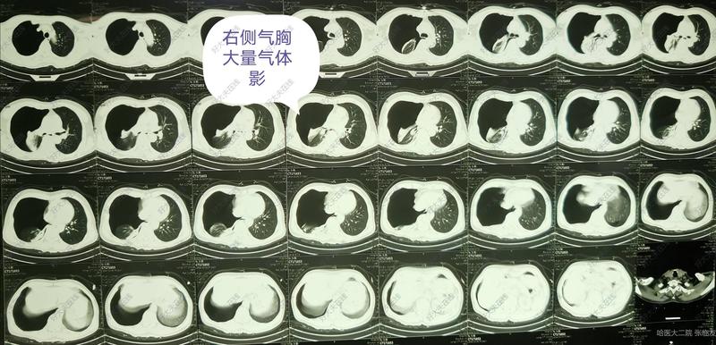 圖文圖片