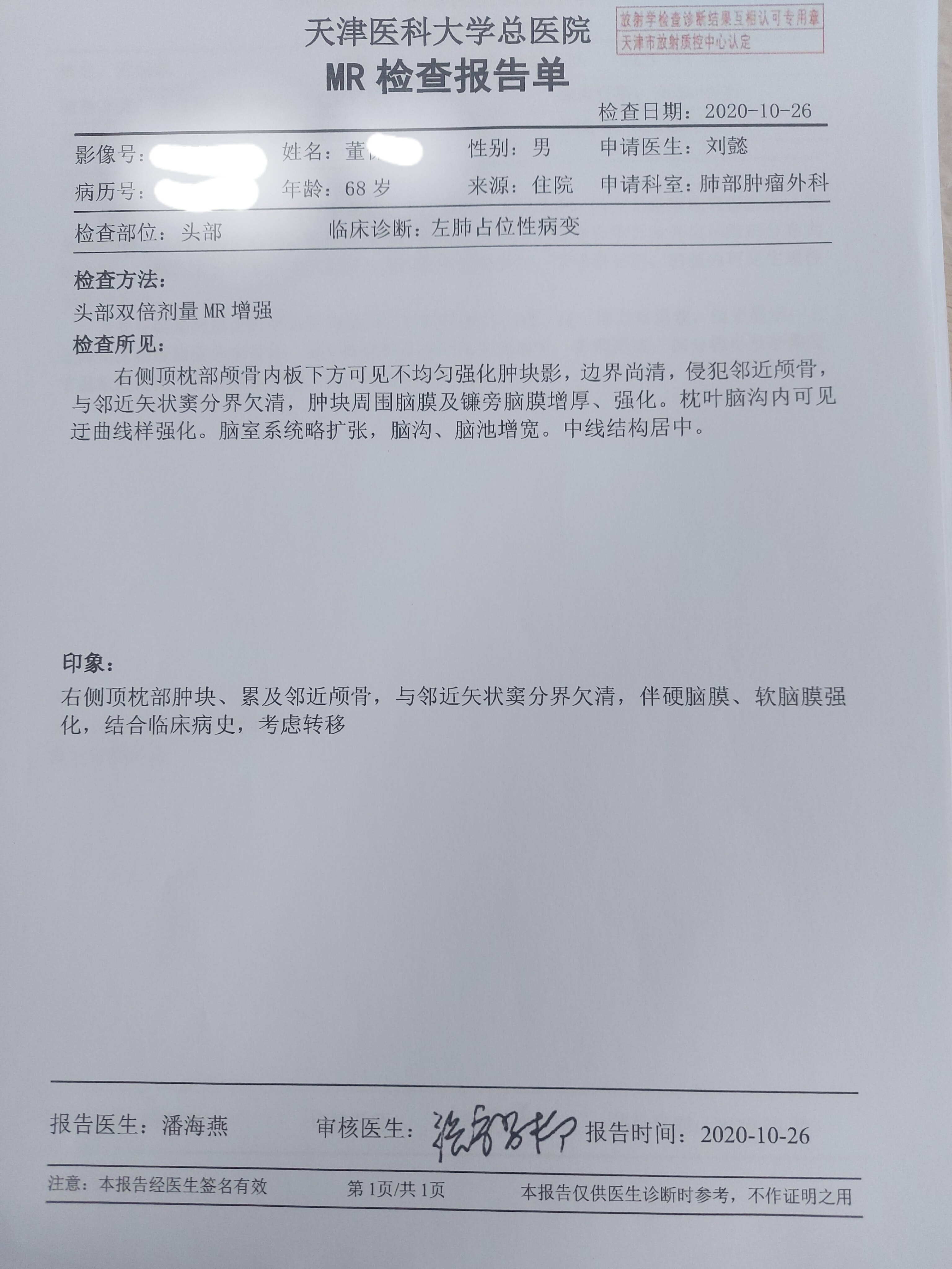 刘懿博士说肺癌(一五亖五)增强核磁报肺癌脑转移,我却说不是!