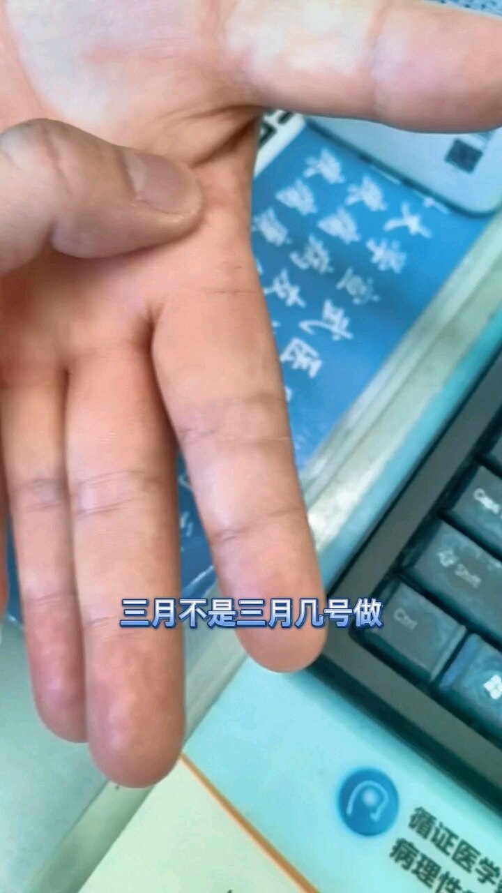 默认图片