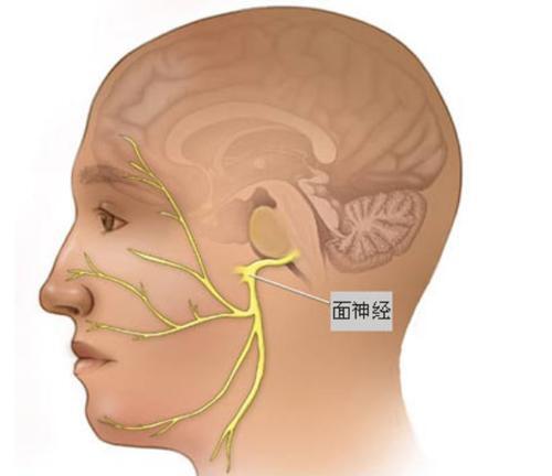 面部的神经很复杂,像重要的五支运动神经是绝对不能碰的(颞支,颧支,颊