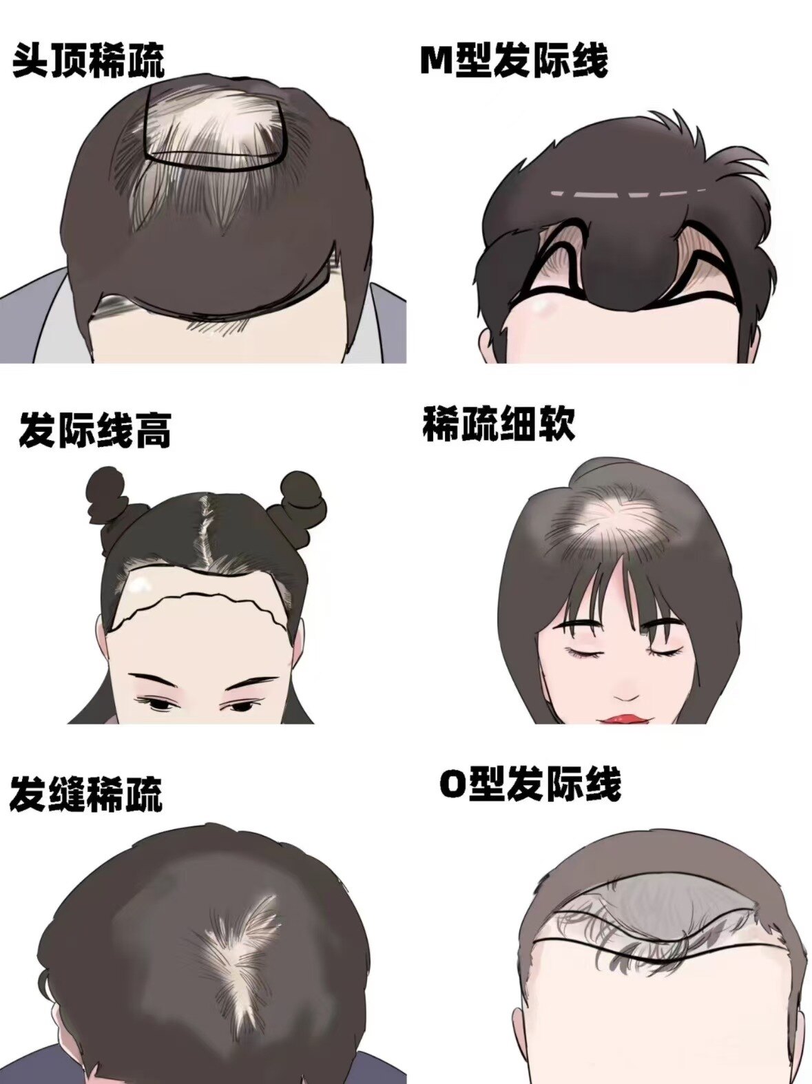 圖文圖片