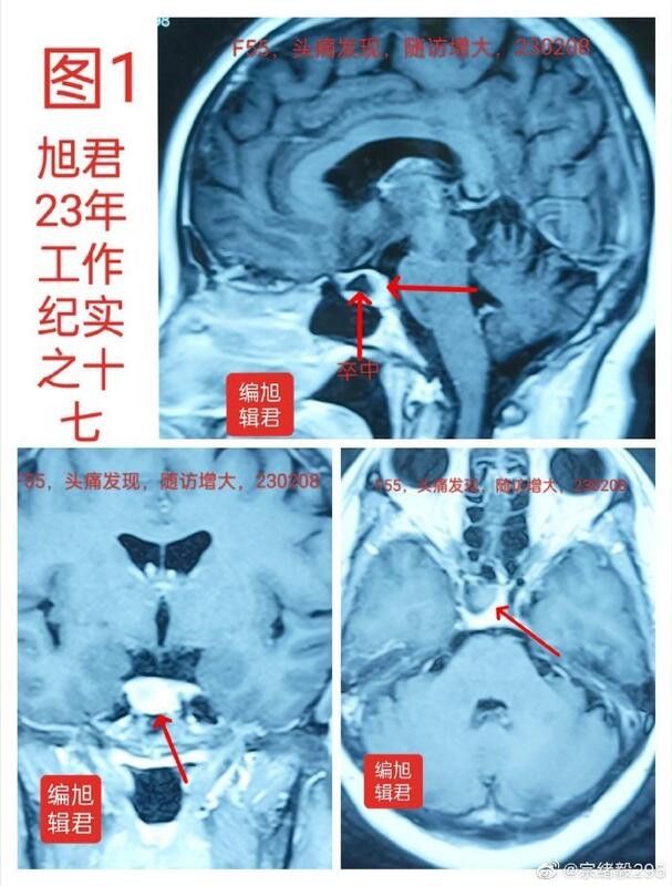 圖文圖片