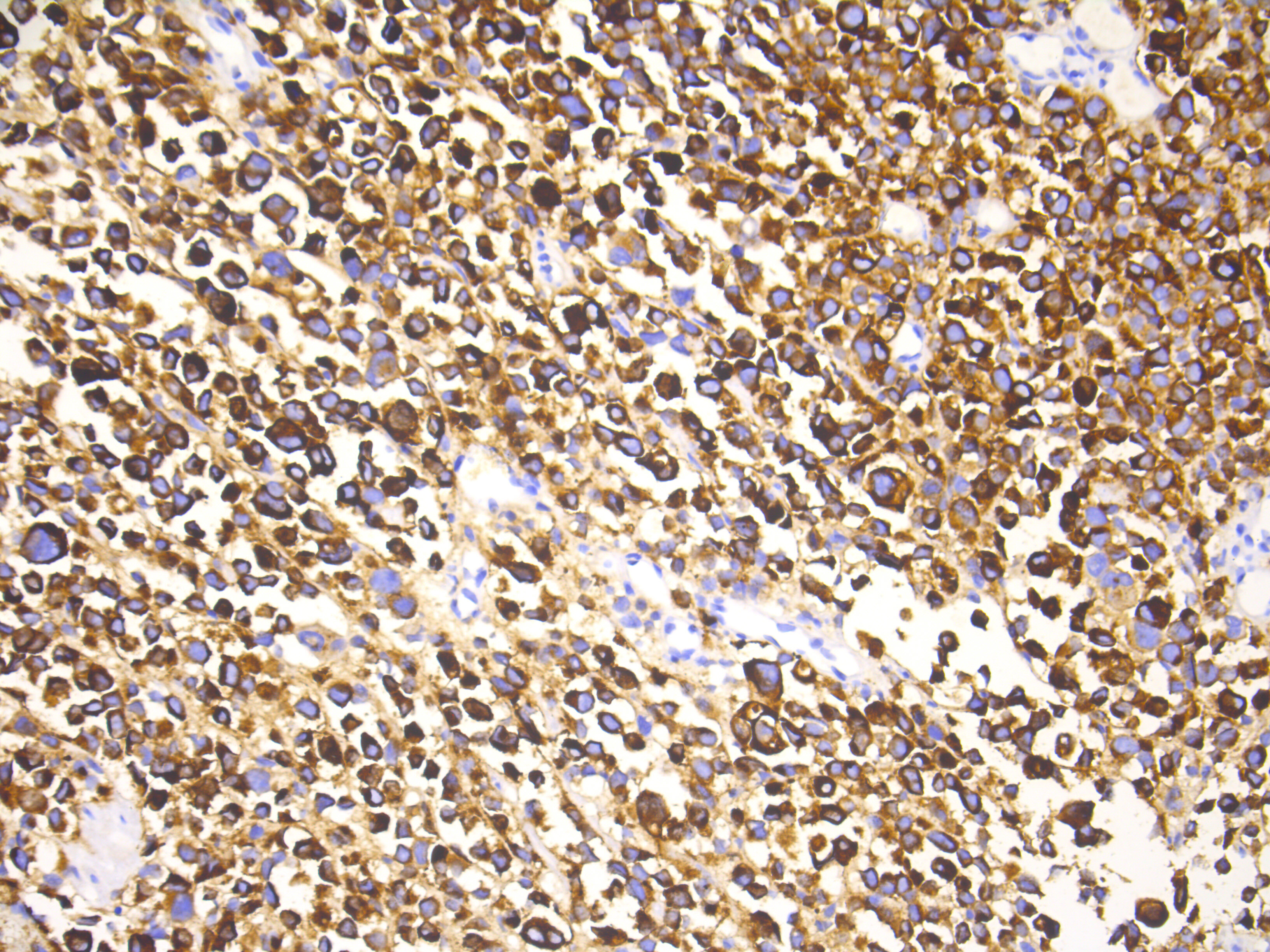 黑色素瘤细胞形态图片