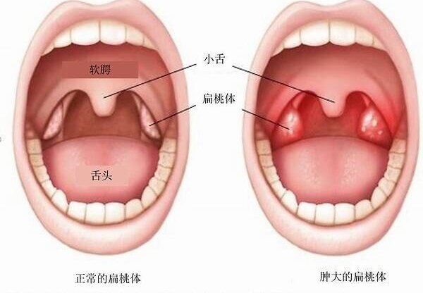 圖文圖片