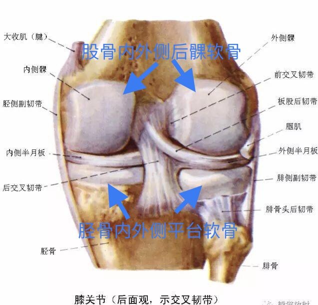 膝关节疾病之游离体 膝关节疾病之游离体