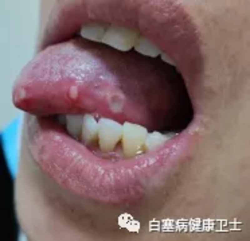 圖文圖片