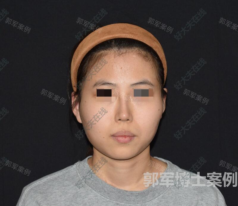 圖文圖片