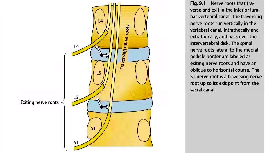 脊柱科普 选择性神经根阻滞"一箭双雕→诊断 治疗_腰椎管狭窄_腰椎
