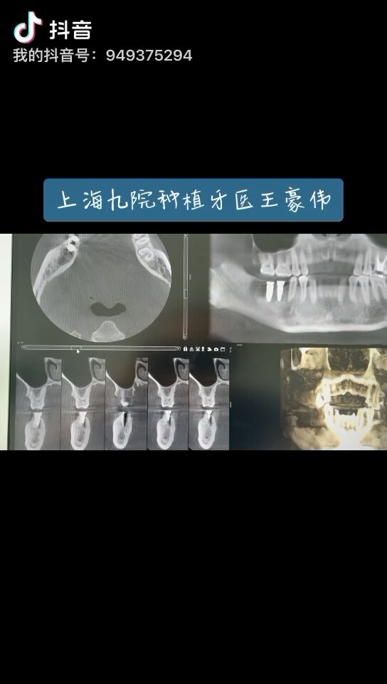 默认图片