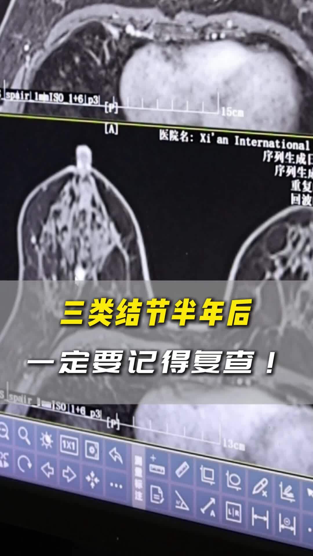 視頻封面