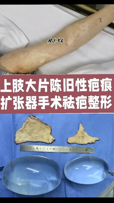 視頻封面