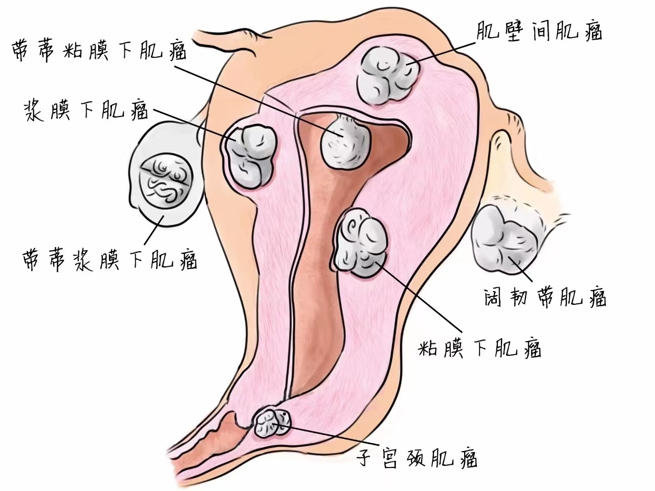 圖文圖片
