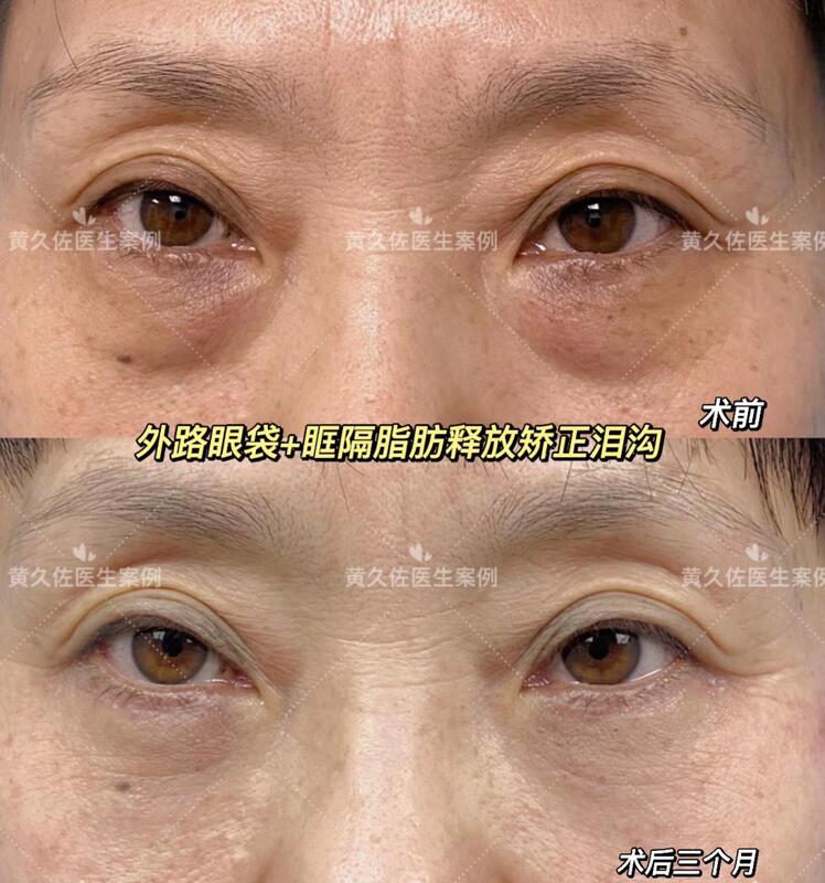 圖文圖片