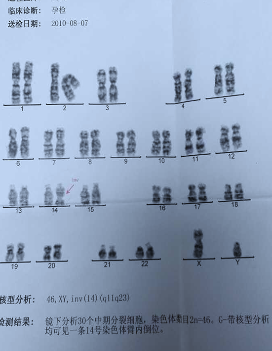 急匆匆 2号染色体为衍生染色体山青水秀