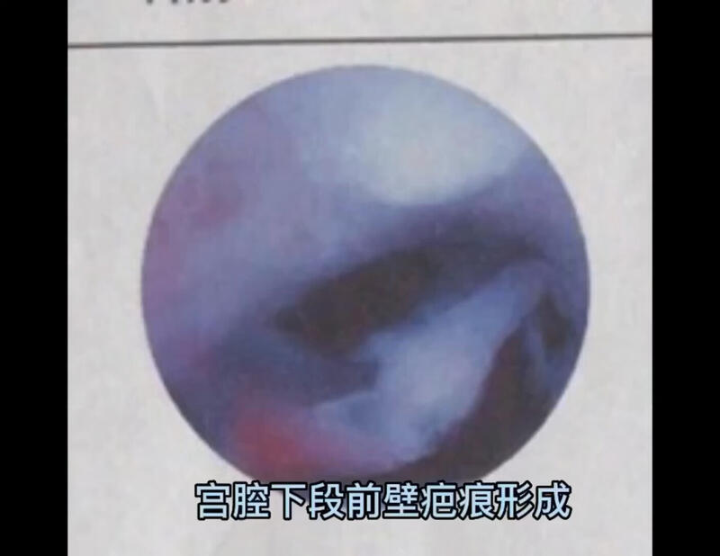 視頻封面