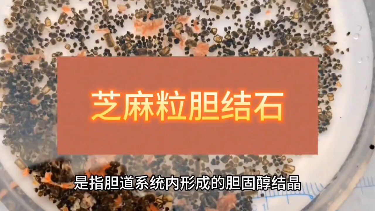 默认图片