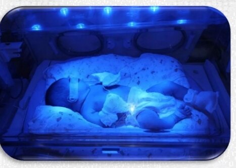 蓝光照射 - 好大夫在线