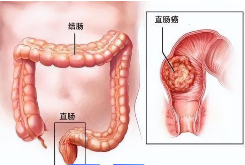 圖文圖片