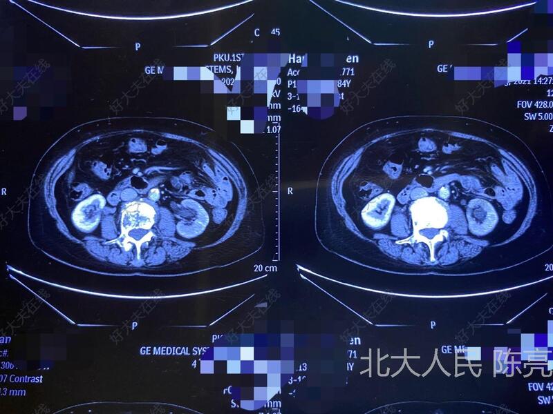 圖文圖片