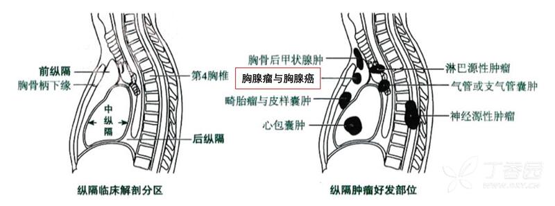 圖文圖片