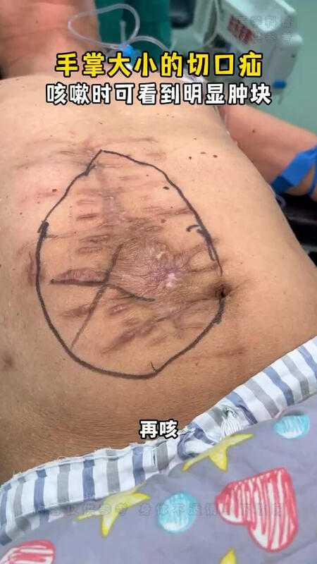 視頻封面