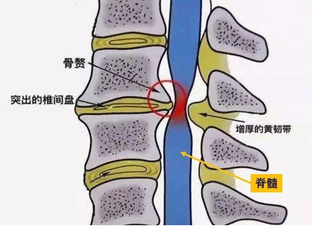 圖文圖片