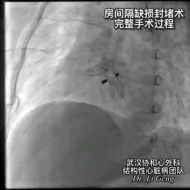 視頻封面