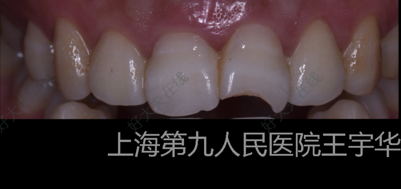 圖文圖片